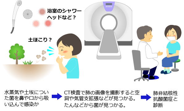 肺非結核性抗酸菌症診断の流れ